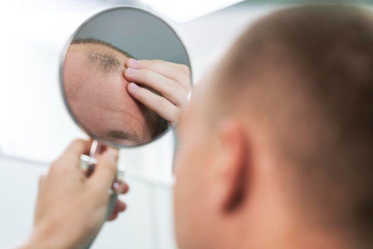 hombre-con-alopecia-probando-cafeína-en-polvo-buena-para-el-cabello